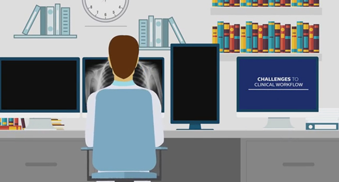 V&iacute;deo de la soluci&oacute;n Radiology Workspace