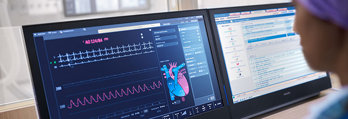 Ventana emergente de tratamiento de coronariopat&iacute;as con Xper IM