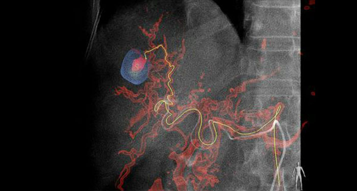emboguide_interventional_xray_systems