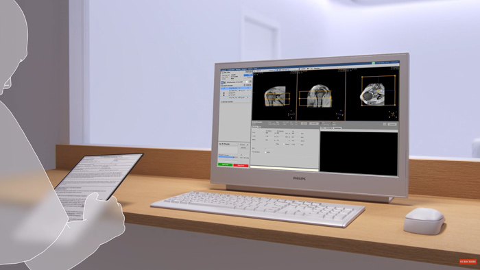 V&iacute;deo que muestra Philips SmartWorkflow en acci&oacute;n