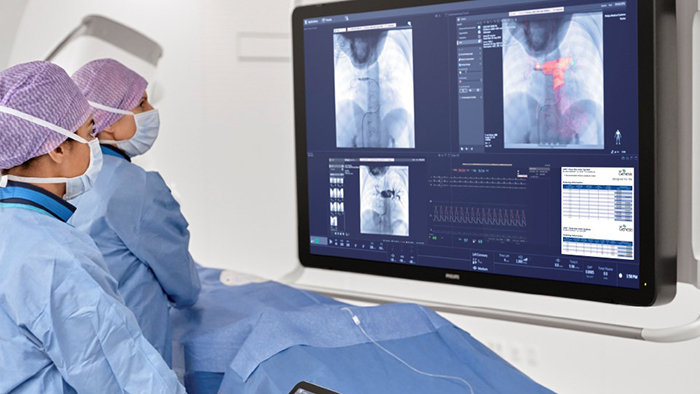 Intervenciones de cardiopatías congénitas