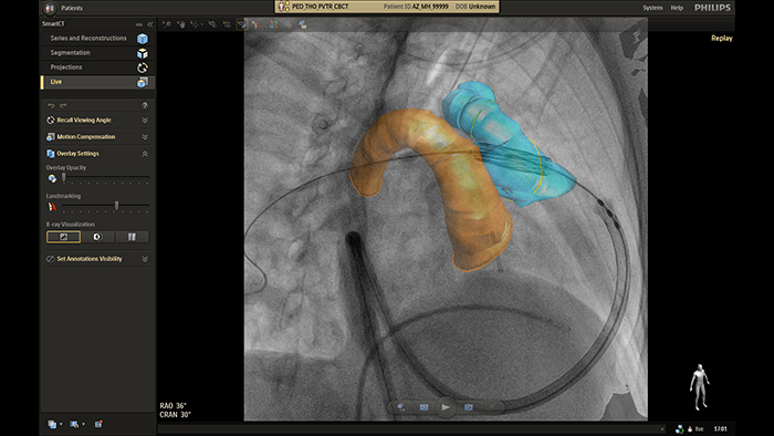 Gu&iacute;a en tiempo real de SmartCT