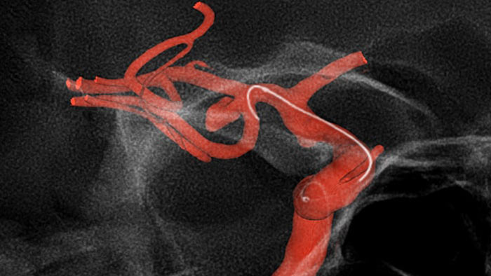 Visualizaci&oacute;n mejorada con SmartCT Roadmap