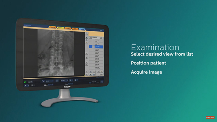 El flujo de trabajo Eleva impulsa la adquisici&oacute;n de im&aacute;genes