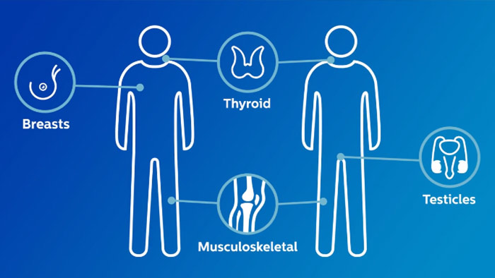 V&iacute;deo en el que se describe el sistema de ultrasonidos avanzado de Philips para partes blandas