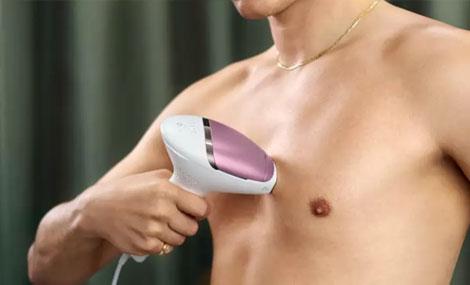 Hirsutismo en mujeres: causas y tratamiento