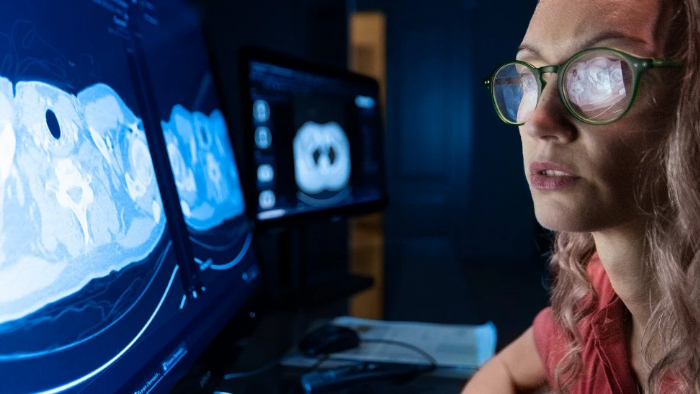 Philips impulsa una nueva era de IA integrada en radiolog&iacute;a para mejorar la eficiencia cl&iacute;nica y la calidad asistencial